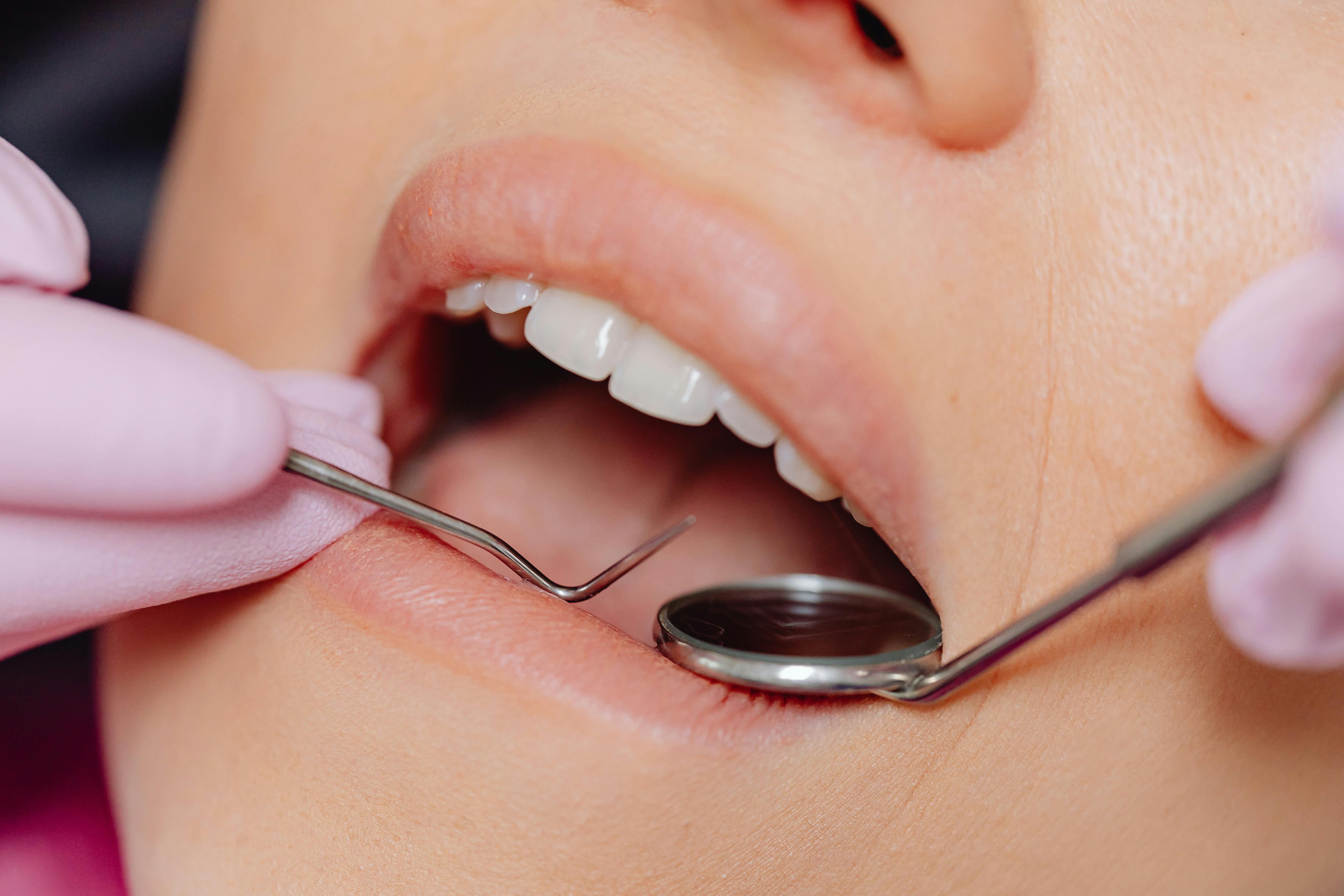 Painless Tooth Extractione
