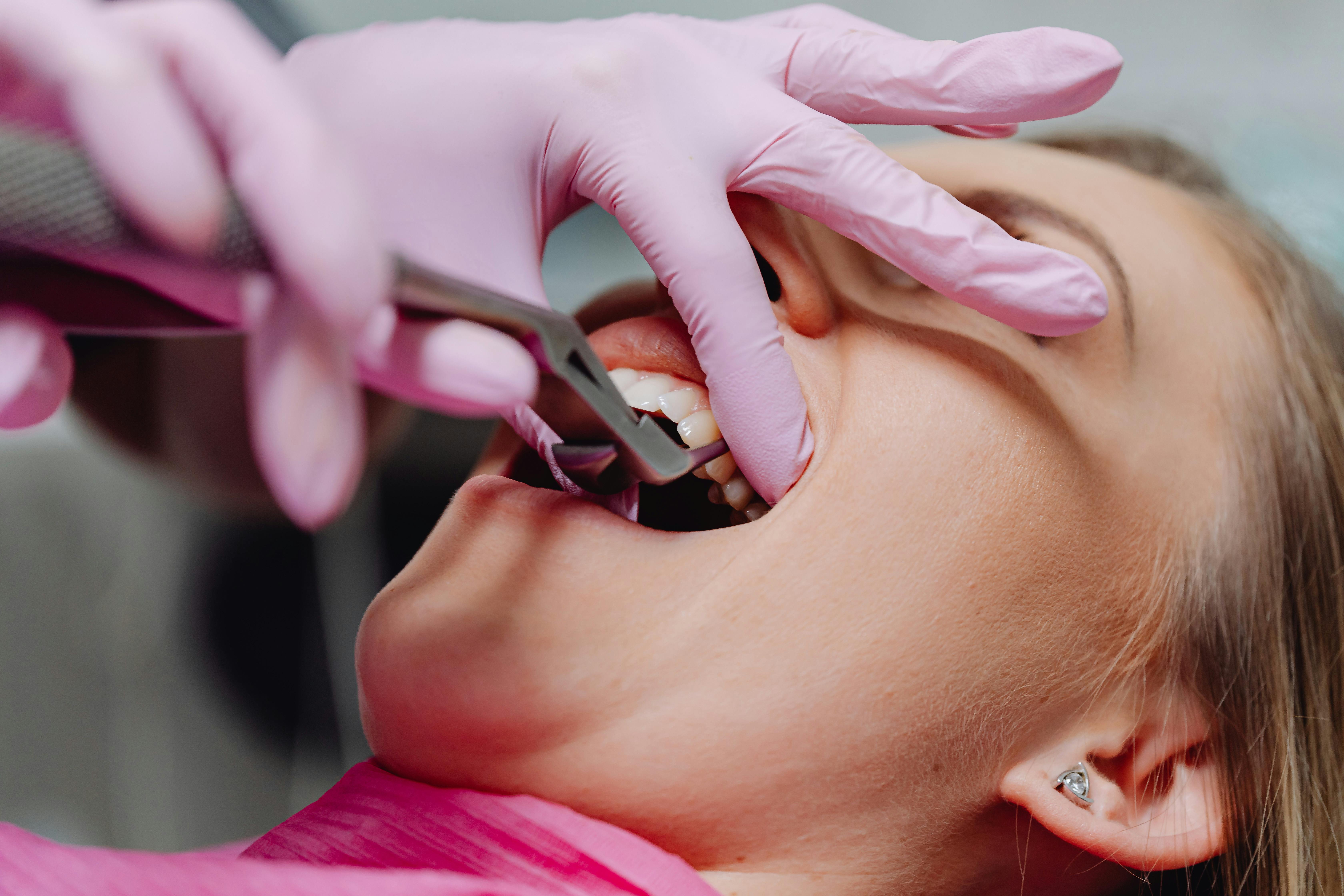 Painless Tooth Removal